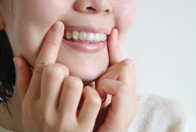 マウスピース矯正で出っ歯はきれいに治る？矯正方法について