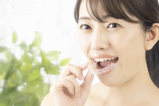 リテーナーとは?矯正後に必須の保定期間・種類・正しい使い方と注意点